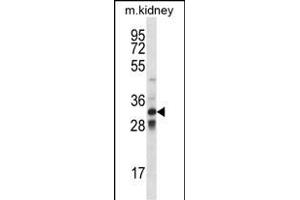 TLX1 Antibody (Center) (ABIN656421 and ABIN2845712) western blot analysis in mouse kidney tissue lysates (35 μg/lane). (TLX1 抗体  (AA 163-191))