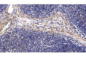 Detection of FMOD in Porcine Lymph node Tissue using Polyclonal Antibody to Fibromodulin (FMOD)