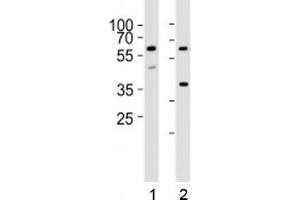 Western blot analysis of lysate from 1) HT-29 and 2) K562 cell lines using RIPK3 antibody at 1:1000. (RIPK3 抗体  (AA 61-91))