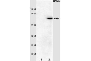 L1 rat brain lysates L2 mouse embryo lysates probed with Anti phospho-Cdc25B (Ser186) Polyclonal Antibody, Unconjugated (ABIN756967) at 1:200 overnight at 4 °C.