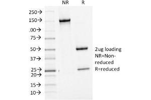 SDS-PAGE Analysis Purified bcl-6 Mouse Monoclonal Antibody (BCL6/1475). (BCL6 抗体  (AA 256-389))