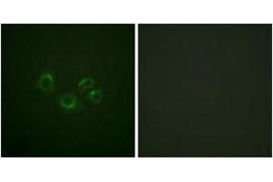 Immunofluorescence analysis of A549 cells, using EPHA2/3/4 (Ab-588/596) Antibody. (EPHA2/3/4 抗体  (AA 556-605))