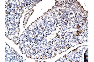 Formalin-fixed and paraffin embedded rat pancreatic tissue labeled with Anti-GIP Polyclonal Antibody, Unconjugated (ABIN724850) at 1:200, followed by conjugation to the secondary antibody and DAB staining (GIP 抗体  (AA 52-93))