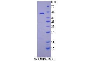 SDS-PAGE analysis of Human PSMD7 Protein. (PSMD7 蛋白)