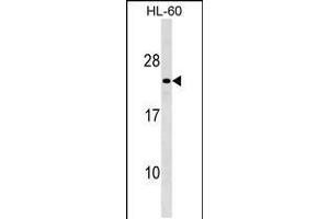 Western blot analysis in HL-60 cell line lysates (35ug/lane). (Membrane-Spanning 4-Domains, Subfamily A, Member 8 (MS4A8) (AA 44-70), (N-Term) 抗体)