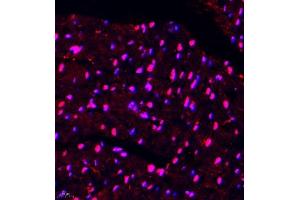Immunofluorescence of paraffin embedded mouse heart using DGKI (ABIN7073721) at dilution of 1:650 (400x lens) (DGKI 抗体)
