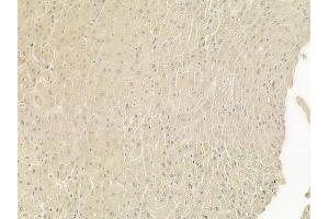 ABIN6266026 and ABIN6277560 at 1/100 staining human normal liver tissue by IHC-P. (WIF1 抗体  (Internal Region))