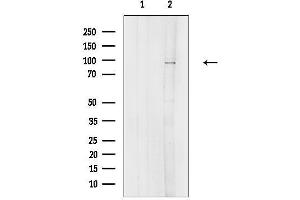 Western blot analysis of lysates from K562 cells(serum starvation treatment), using NEK4 Antibody.