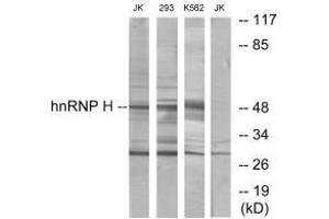 Western blot analysis of extracts from Jurkat cells, 293 cells and K562 cells, using hnRNP H antibody. (HNRNPH2 抗体)