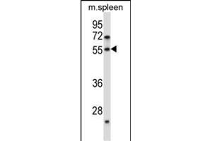 DOK7 Antibody (N-term) (ABIN657491 and ABIN2846518) western blot analysis in mouse spleen tissue lysates (35 μg/lane). (DOK7 抗体  (N-Term))