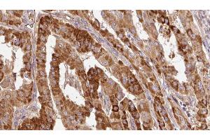 anti-Discs, Large (Drosophila) Homolog-Associated Protein 1 (DLGAP1) (pSer346) antibody