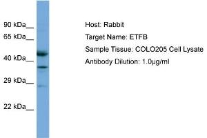 Host: Rabbit Target Name: ETFB Sample Tissue: Human COLO205 Whole Cell Antibody Dilution: 1ug/ml (ETFB 抗体  (C-Term))
