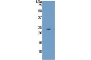 WB of Protein Standard: different control antibodies against Highly purified E. (RBP4 ELISA 试剂盒)