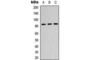 Western blot analysis of Beta-glucuronidase expression in K562 (A), HeLa (B), HepG2 (C) whole cell lysates. (Glucuronidase beta 抗体  (Center))