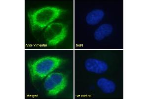 Immunofluorescence (IF) image for anti-Vimentin (VIM) (C-Term) antibody (ABIN2613493)