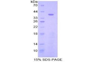 SDS-PAGE analysis of Mouse STAP1 Protein. (STAP1 蛋白)