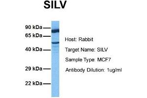 Host:  Rabbit  Target Name:  SILV  Sample Tissue:  Human MCF7  Antibody Dilution:  1. (Melanoma gp100 抗体  (N-Term))