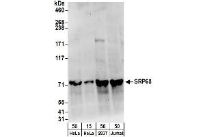 Western Blotting (WB) image for anti-Signal Recognition Particle 68kDa (SRP68) (AA 1-50) antibody (ABIN7450775) (SRP68 抗体  (AA 1-50))