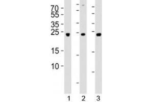 Western blot analysis of lysate from 1) 293, 2) SW620, and 3) U-87 MG cell line using UCHL3 antibody at 1:1000. (UCHL3 抗体  (AA 195-225))