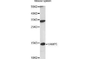 Western blot analysis of extracts of mouse spleen, using VAMP5 antibody (ABIN6292345) at 1:3000 dilution. (VAMP5 抗体)