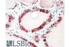 ABIN768643 (5µg/ml) staining of paraffin embedded Human Thyroid Gland. (Thyroperoxidase 抗体  (C-Term))