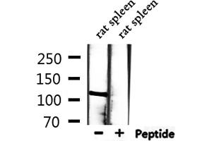 Western blot analysis of extracts from rat spleen, using MCM2 Antibody. (MCM2 抗体  (N-Term))