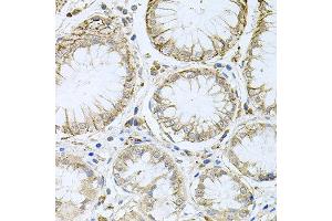 Immunohistochemistry of paraffin-embedded human stomach using HPS1 antibody at dilution of 1:100 (x40 lens).