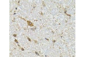 Immunohistochemistry of paraffin-embedded Mouse brain using COQ3 Polyclonal Antibody at dilution of 1:100 (40x lens). (COQ3 抗体)