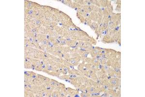 Immunohistochemistry of paraffin-embedded mouse heart using VDAC1 antibody at dilution of 1:100 (400x lens). (VDAC1 抗体)