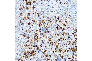Immunohistochemistry of paraffin-embedded mouse spleen using Hivep3 Rabbit pAb (ABIN7267792) at dilution of 1:50 (40x lens). (Human Immunodeficiency Virus Type I Enhancer Binding Protein 3 (HIVEP3) 抗体)