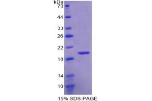 SDS-PAGE analysis of Human RBM20 Protein. (RBM20 蛋白)