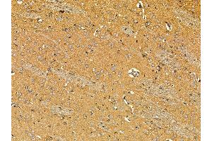 ABIN7095633 and ABIN7099695 at 1/100 staining rat brain tissue by IHC-P. (POU6F1 抗体)