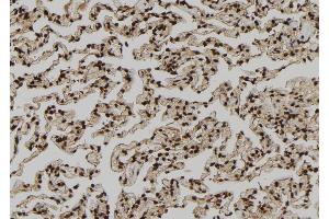 ABIN6279212 at 1/100 staining Human lung tissue by IHC-P. (PDE1A 抗体  (Internal Region))