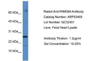WB Suggested Anti-FAM36A Antibody Titration: 0. (FAM36A 抗体  (C-Term))