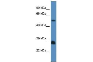 Western Blot showing Shc3 antibody used at a concentration of 1. (SHC3 抗体  (N-Term))