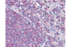 IHC-P Image Immunohistochemical analysis of paraffin-embedded human Spleen, using gamma Actin, antibody(10 μg/ml). (Actin, gamma 1 抗体  (N-Term))