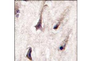Formalin-fixed and paraffin-embedded human brain tissue reacted with PKC beta2 antibody (C-term), which was peroxidase-conjugated to the secondary antibody, followed by DAB staining. (PKC beta 抗体  (C-Term))