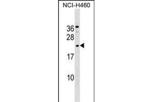 GLIPR1L1 Antibody (C-term) (ABIN1536826 and ABIN2849524) western blot analysis in NCI- cell line lysates (35 μg/lane). (GLIPR1L1 抗体  (C-Term))