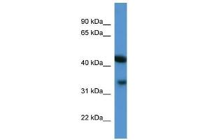 Centa1 antibody used at 0. (ADAP1 抗体  (C-Term))