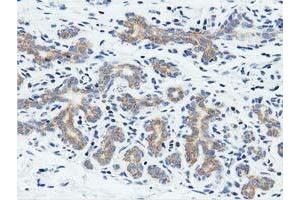 Immunohistochemical staining of paraffin-embedded Human breast tissue using anti-RIT2 mouse monoclonal antibody. (RIT2 抗体)