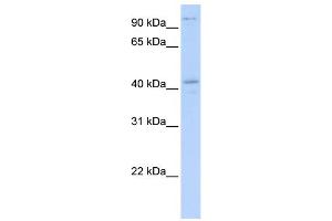 WB Suggested Anti-FGD1 Antibody Titration:  0. (FGD1 抗体  (N-Term))