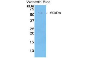 Western blot analysis of the recombinant protein. (CILP 抗体  (AA 603-846))