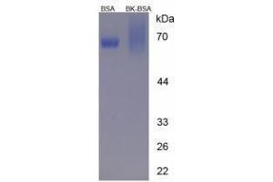 Image no. 2 for Kininogen 1 (KNG1) peptide (BSA) (ABIN5665946) (Kininogen 1 (KNG1) peptide (BSA))