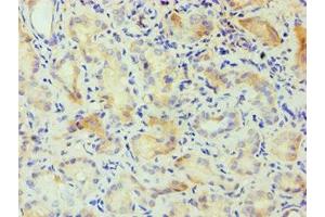 Immunohistochemistry (IHC) image for anti-Casein Kinase 1, alpha 1-Like (CSNK1A1L) (AA 1-337), (Isoform alpha) antibody (ABIN7146856)