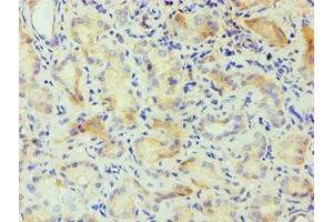 Immunohistochemistry of paraffin-embedded human kidney tissue using ABIN7146856 at dilution of 1:100 (CSNK1A1L 抗体  (Isoform alpha))