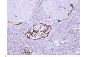 Figure 2. (SOCS5 抗体  (N-Term))