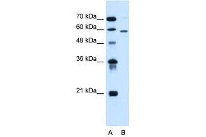 ALG11 antibody used at 1 ug/ml to detect target protein. (ALG11 抗体  (C-Term))