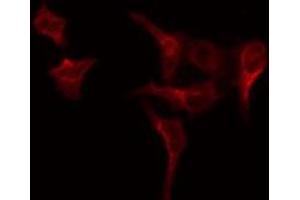 ABIN6275001 staining COLO205 by IF/ICC. (CLCC1 抗体  (Internal Region))