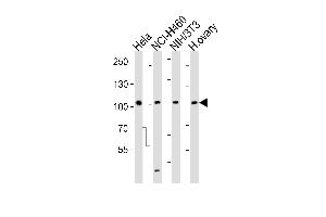 Western blot analysis of lysates from Hela, NCI-H460, mouse NIH/3T3 cell line and human ovary tissue lysate (from left to right), using EPHA4 Antibody (R890) at 1:1000 at each lane. (EPH Receptor A4 抗体  (C-Term))