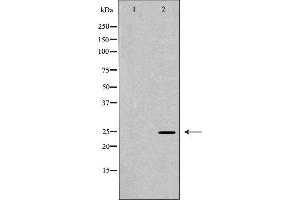 Western blot analysis of Hela whole cell lysates, using PSMA2 Antibody. (PSMA2 抗体  (Internal Region))